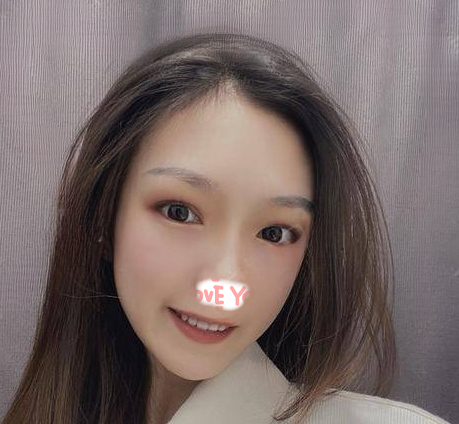 自体脂肪胶