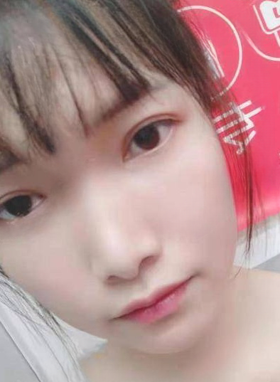 去眼袋手术
