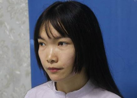 去眼袋手术