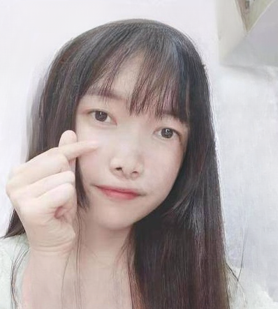 去眼袋手术