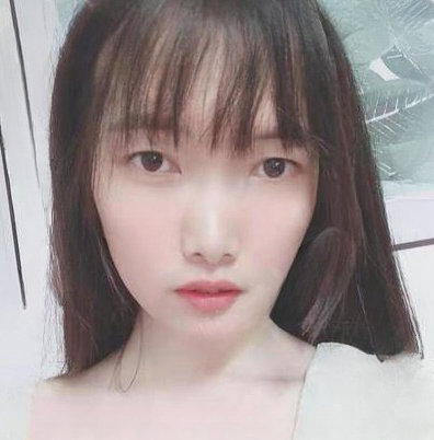 去眼袋手术