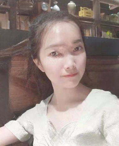 去眼袋手术