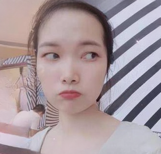去眼袋手术