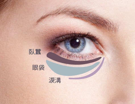 去眼袋手术