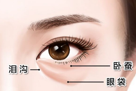 去眼袋手术