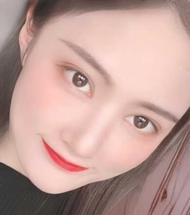 双眼皮手术