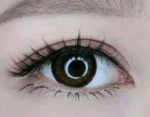 双眼皮手术