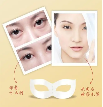 去眼袋手术