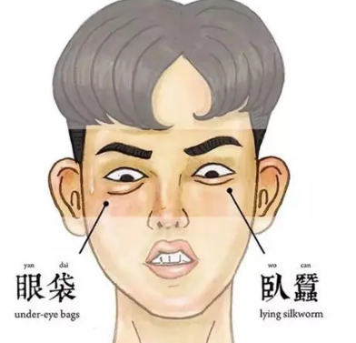 去眼袋手术