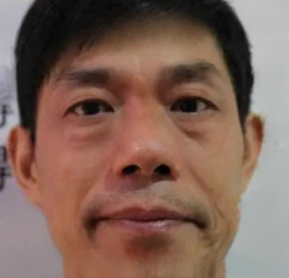 去眼袋手术