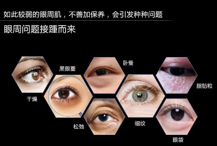 眼袋