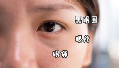 眼袋