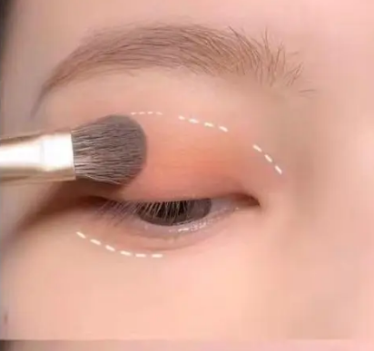 去眼袋手术