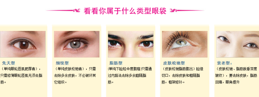 去眼袋手术