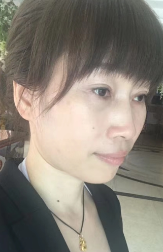 眼袋