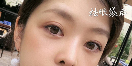 眼袋