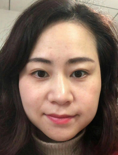眼袋