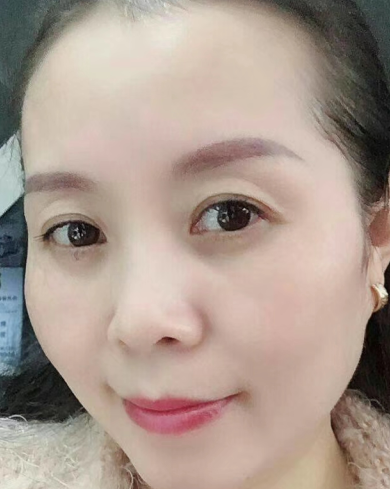 眼袋