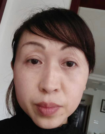眼袋