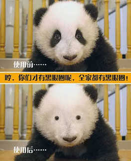 去眼袋手术