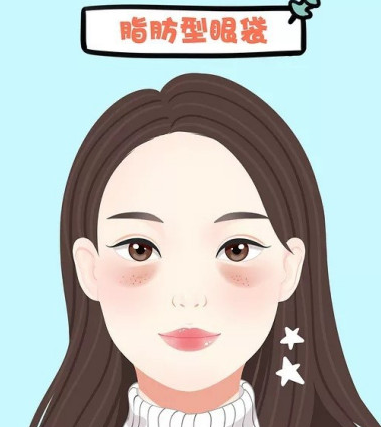 去眼袋手术