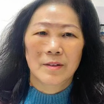 去眼袋手术