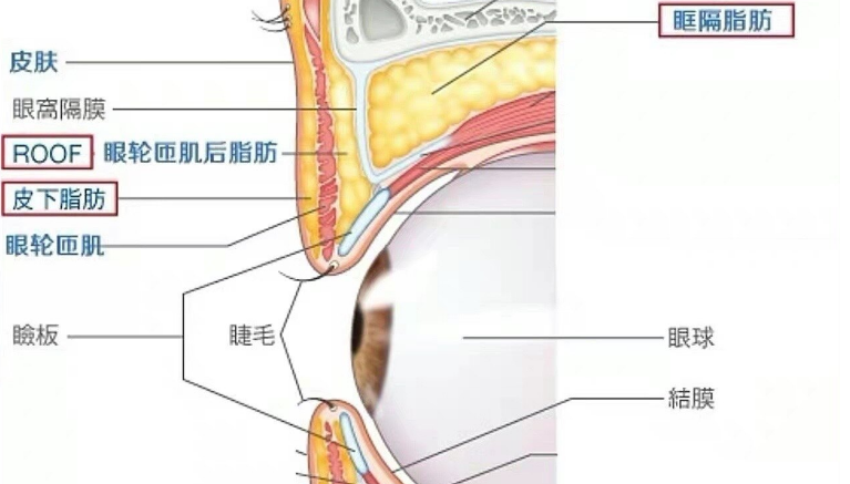 去眼袋手术