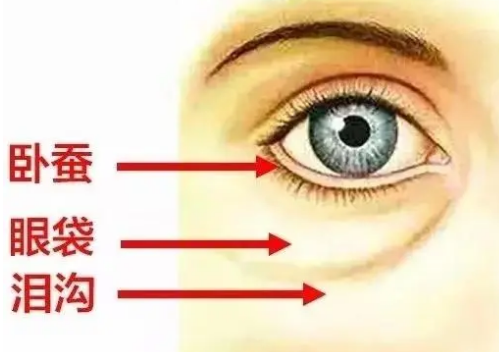 去眼袋手术
