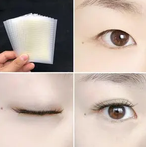 双眼皮手术