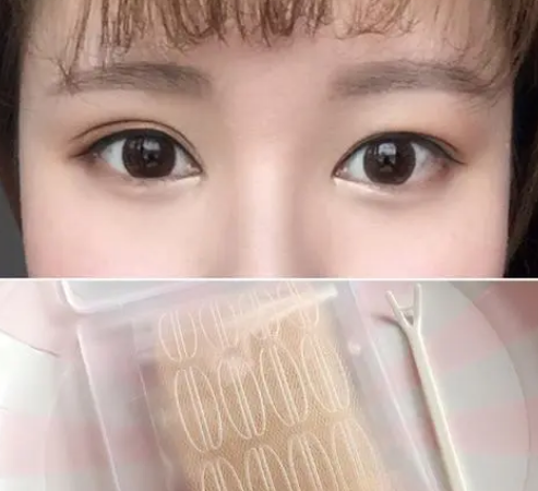 双眼皮手术