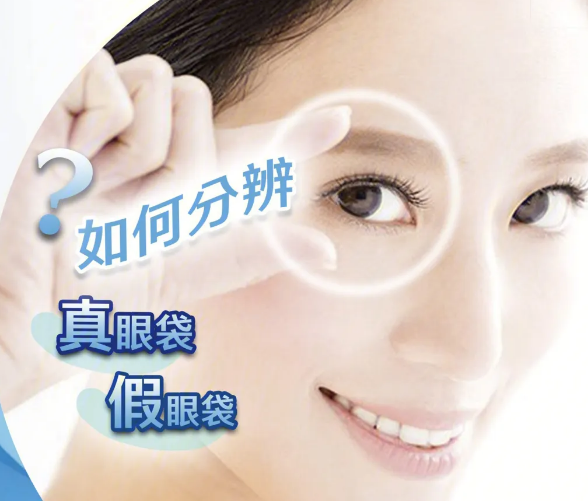 眼袋