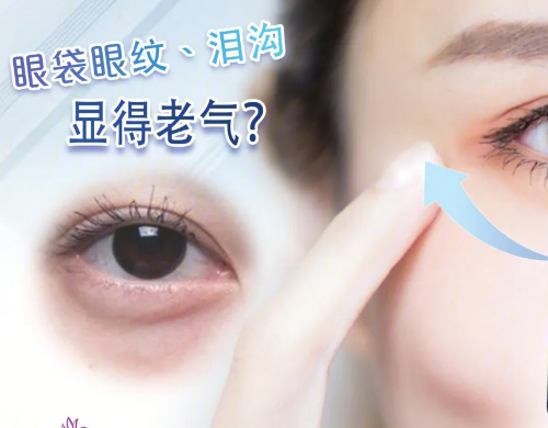 眼袋
