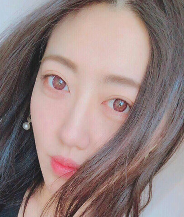 眼袋