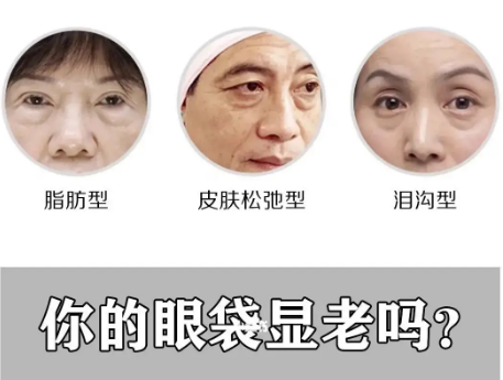 眼袋