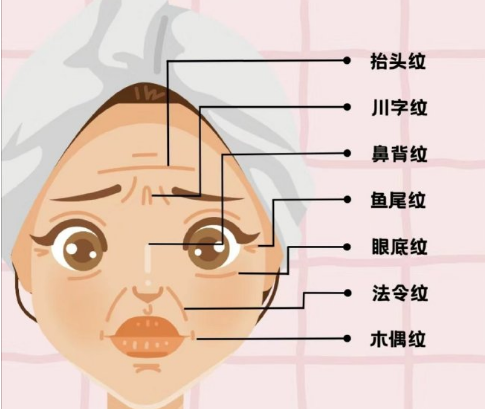 眼袋
