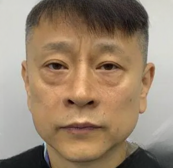 去眼袋手术