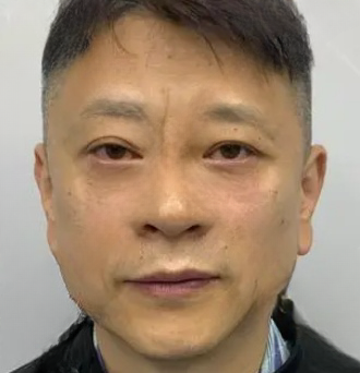 去眼袋手术