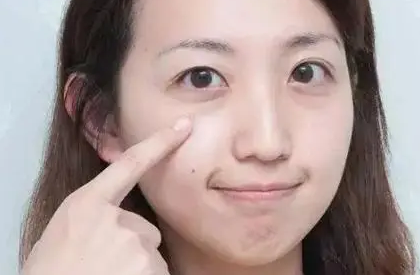 泪沟填充