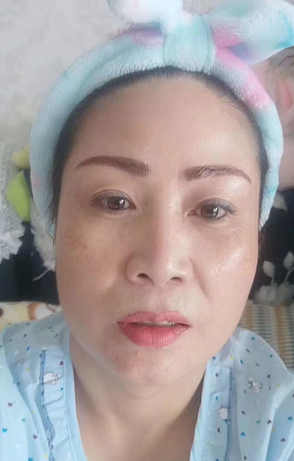 眼袋