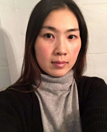 眼袋