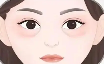 外切眼袋