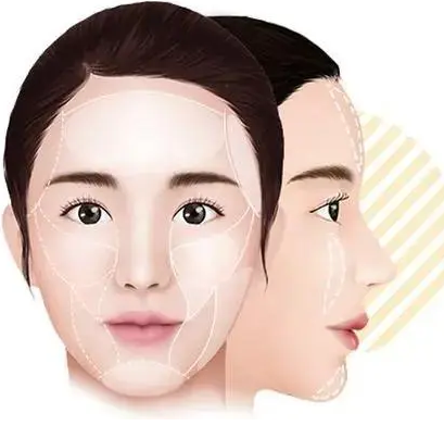 眼袋手术