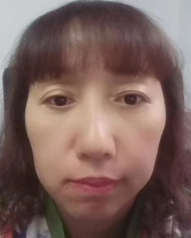 去眼袋手术