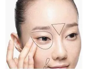 眼袋