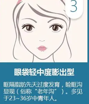 去眼袋手术
