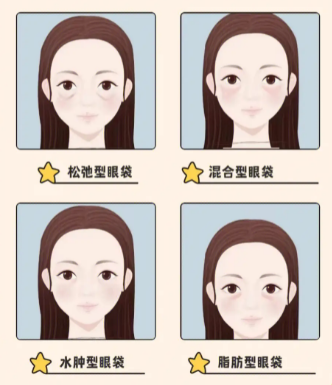 去眼袋手术