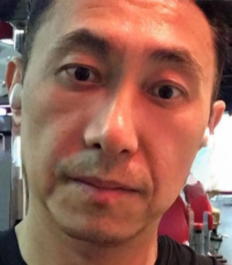 去眼袋手术