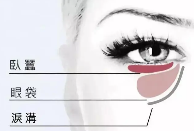 去眼袋手术