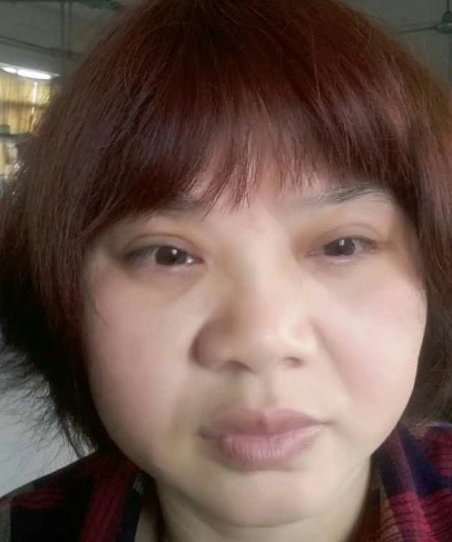 眼袋