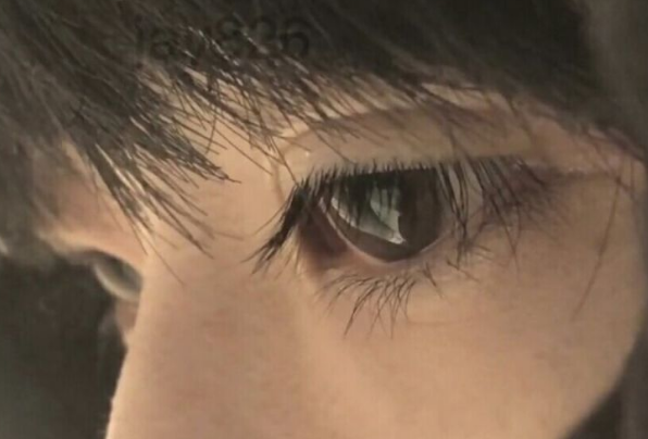 眼袋